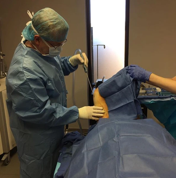 Surgeon in surgical cap and mask preparing a patient draped in blue surgical sheets for a penis filler procedure